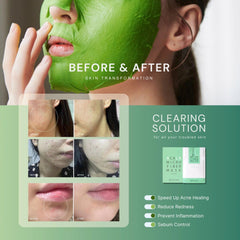 Soonsu Beauty Acala Micro Fiber Mask front view Soonsu Beauty Acala Micro Fiber Mask front view