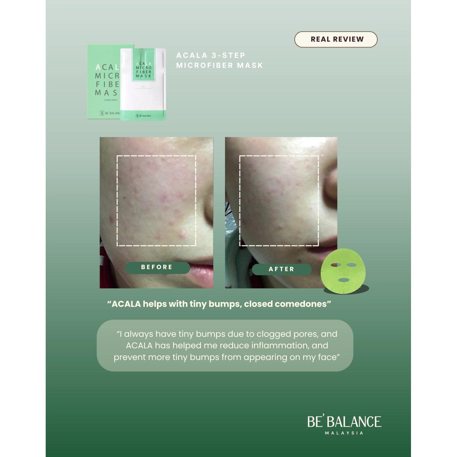 Soonsu Beauty Acala Micro Fiber Mask application use Soonsu Beauty Acala Micro Fiber Mask application use