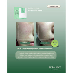 Soonsu Beauty Acala Micro Fiber Mask application use Soonsu Beauty Acala Micro Fiber Mask application use