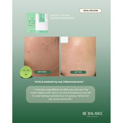 Soonsu Beauty Acala Micro Fiber Mask side view Soonsu Beauty Acala Micro Fiber Mask side view
