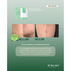 Soonsu Beauty Acala Micro Fiber Mask texture close-up Soonsu Beauty Acala Micro Fiber Mask texture close-up