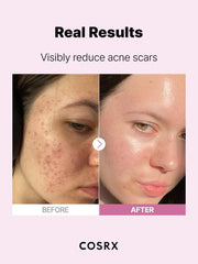 Soonsu Beauty The Niacinamide 15 Serum packaging design Soonsu Beauty The Niacinamide 15 Serum packaging design