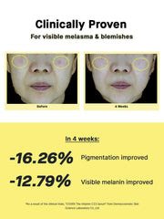 Soonsu Beauty The Vitamin C 23 Serum side view Soonsu Beauty The Vitamin C 23 Serum side view
