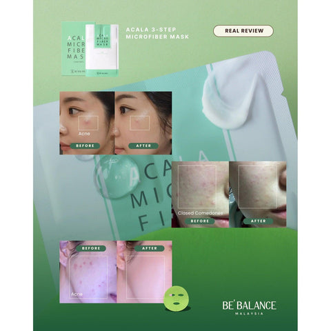 Soonsu Beauty Acala Micro Fiber Mask side view