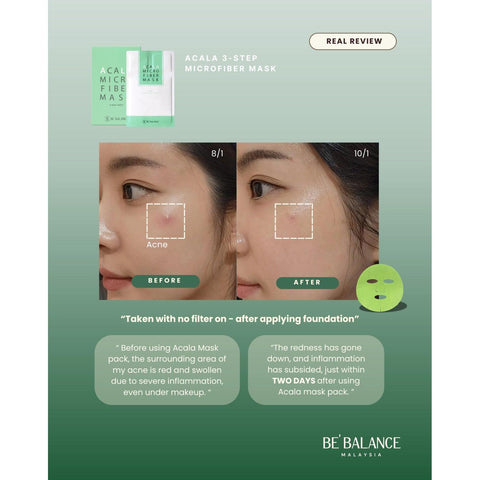Soonsu Beauty Acala Micro Fiber Mask texture close-up