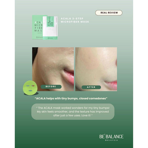 Soonsu Beauty Acala Micro Fiber Mask front view