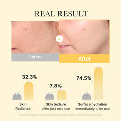 Medicube Kojic Acid Turmeric Gold Jelly Gel Mask 4ea