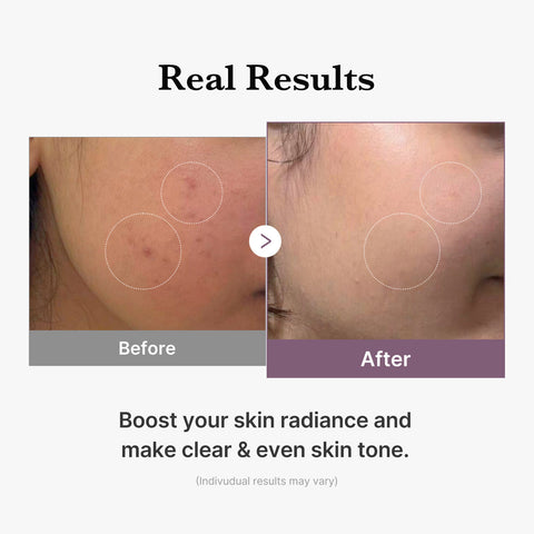 Medicube Age-R Glutathione Glow Milk Toner 140ml