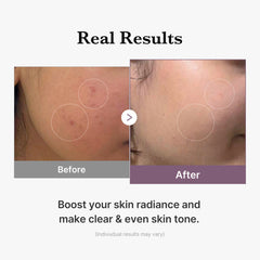 Medicube Age-R Glutathione Glow Milk Toner 140ml