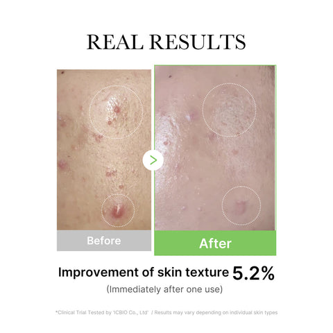 Medicube Exosome Cica Calming Ampoule 30ml