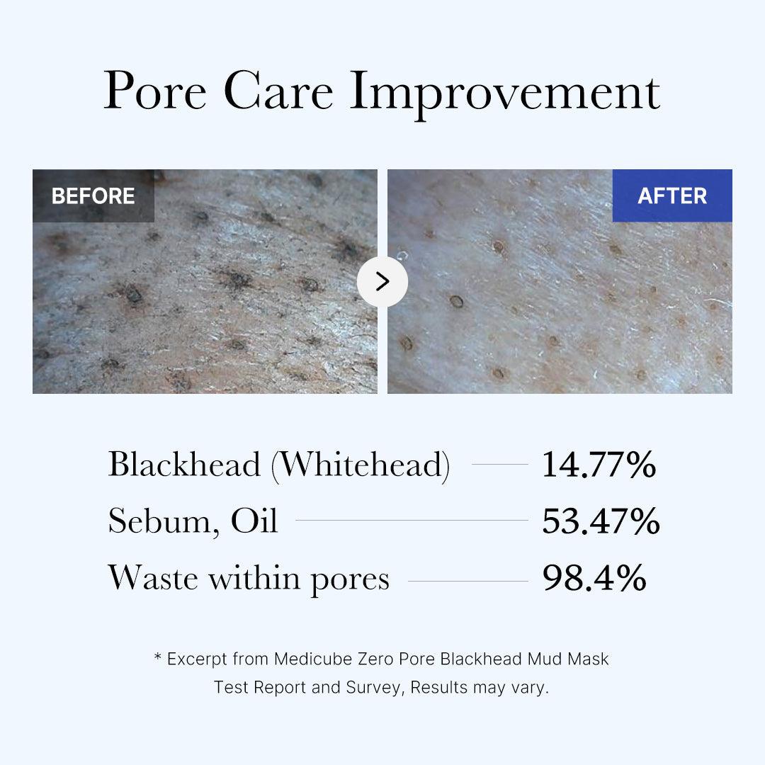Soonsu Beauty Zero Pore Blackhead Mud Mask packaging design