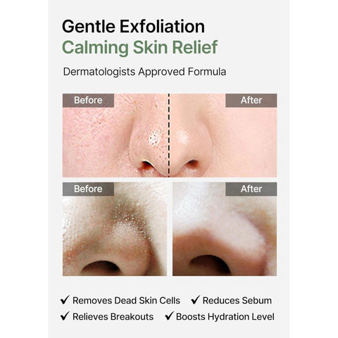 Soonsu Beauty Ji Woo Gae Heartleaf BHA Peeling Pad texture close-up