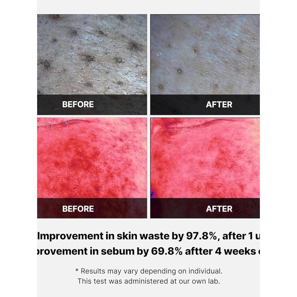 Soonsu Beauty Red Succinic Acid Peeling Pad front view