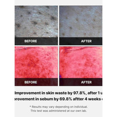 Soonsu Beauty Red Succinic Acid Peeling Pad front view