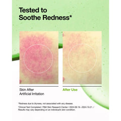 Soonsu Beauty Azelaic Acid 10 Hyaluron Redness Soothing Serum application use