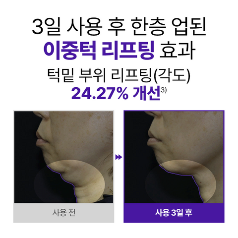 Dermafirm Skin Tension Patch (4 Patches)