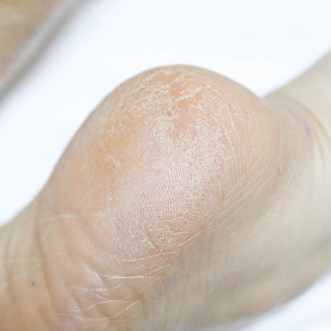 Rire Heel Care Foot Stick 22g