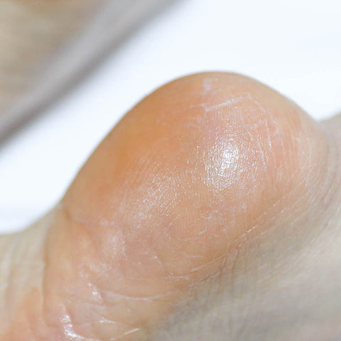 Rire Heel Care Foot Stick 22g