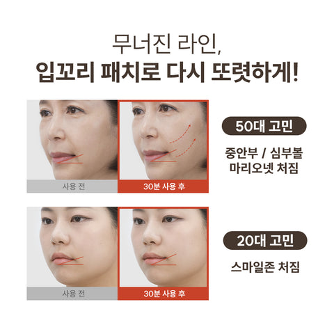 Marshique Line Lifting Hydrogel Smile Corner Patches (6 Patches)