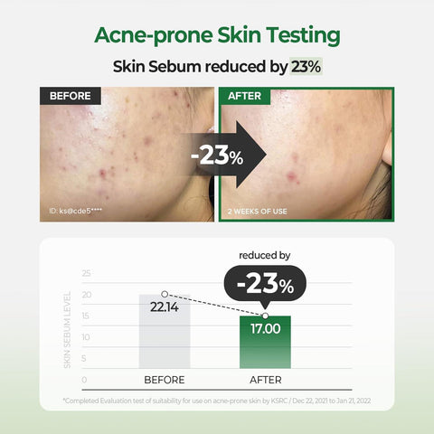 Soonsu Beauty Pantothenic Water Parsley Pad 60pads application use