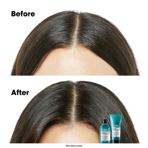 L'Oreal Professionnel Scalp Advanced Anti-Discomfort Shampoo Refill 500ml (Sensitive Scalp)