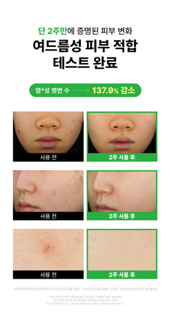 Eiom Trouble Targeting Serum 30ml (2 Pack)