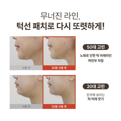 Marshique Line Lifting Hydrogel Jawline Patch (3 patches)