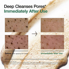 Product packaging with text 'Deep Cleanses Pores* Immediately After Use' and before/after images of skin texture.