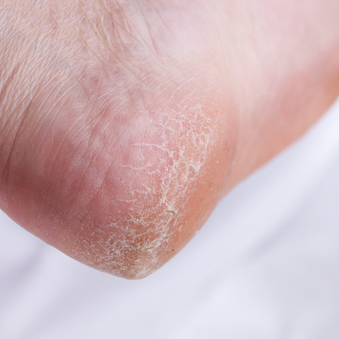 Rire Heel Care Foot Buffer