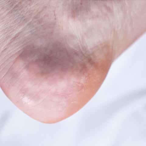 Rire Heel Care Foot Buffer