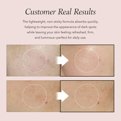 Before and after skin treatment showing dark spots reduction on a beige background.