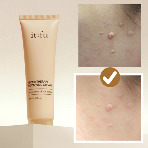Itfu Yulmu Niacinamide Cream 50ml (3 Pack)