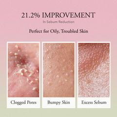 Before and after skin improvement with clogged pores, bumpy skin, and excess sebum on a pink background.