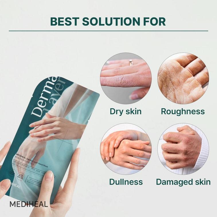 Soonsu Beauty Derma Layer Hand Mask 5 Pack application use