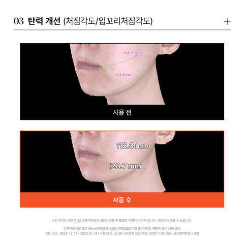 makeON Skin Light Therapy 3S + 2x15 Sheet Masks