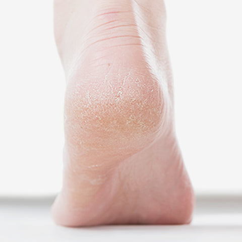 Nard High-Moisture Exfoliating Foot Cream 100ml (4 Pack)