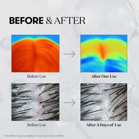 VT PDRN Reedle Shot Hair Ampoule 100dl 15ml