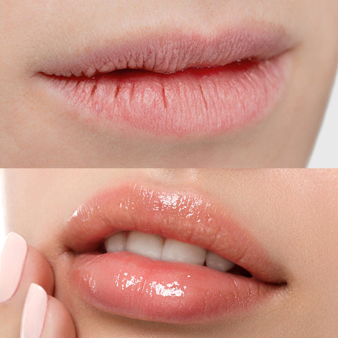 Nard Buke Garni Nard Moisture Lip Balm 10ml (4 Pack)