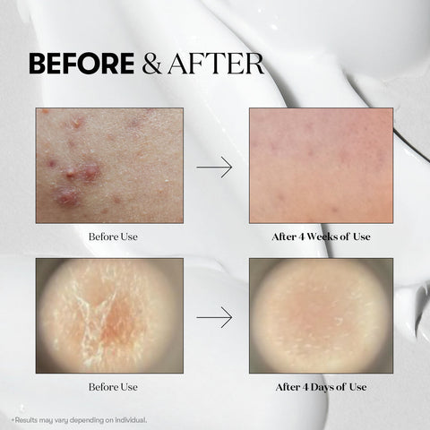 VT Reedle Shot 100 50ml