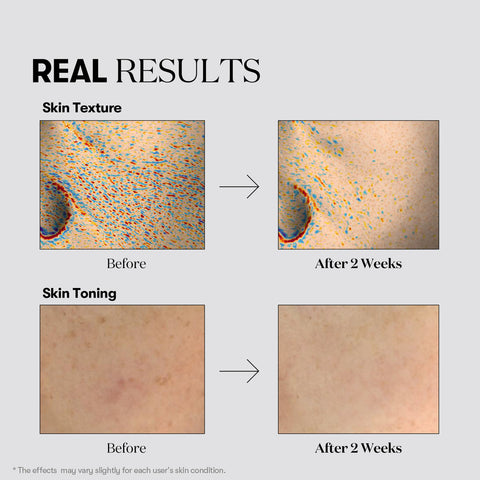VT TX-Toning Essence 1000 Shot 30ml