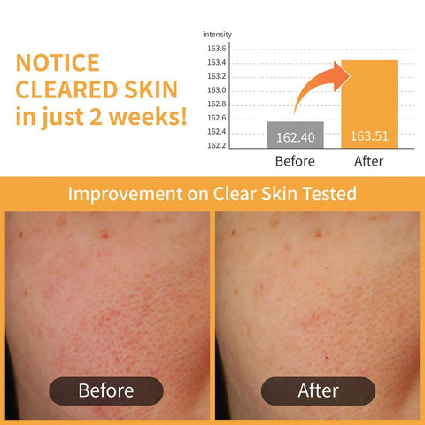 Soonsu Beauty No.3 Radiance Glowing Jumbo Essence Pad 70pads application use