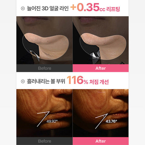 Meditherapy Filligio Pink Retinol Volume Cream 50ml + Pumping Device Set