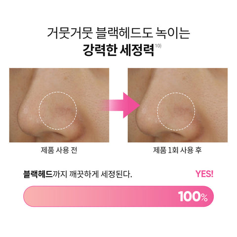 Banila Co Clean It Zero Original Cleansing Balm 180ml