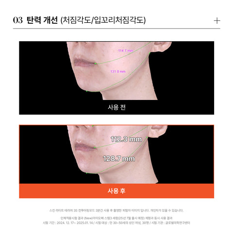 makeON Skin Light Therapy 3S + Gem Sono Therapy Relief