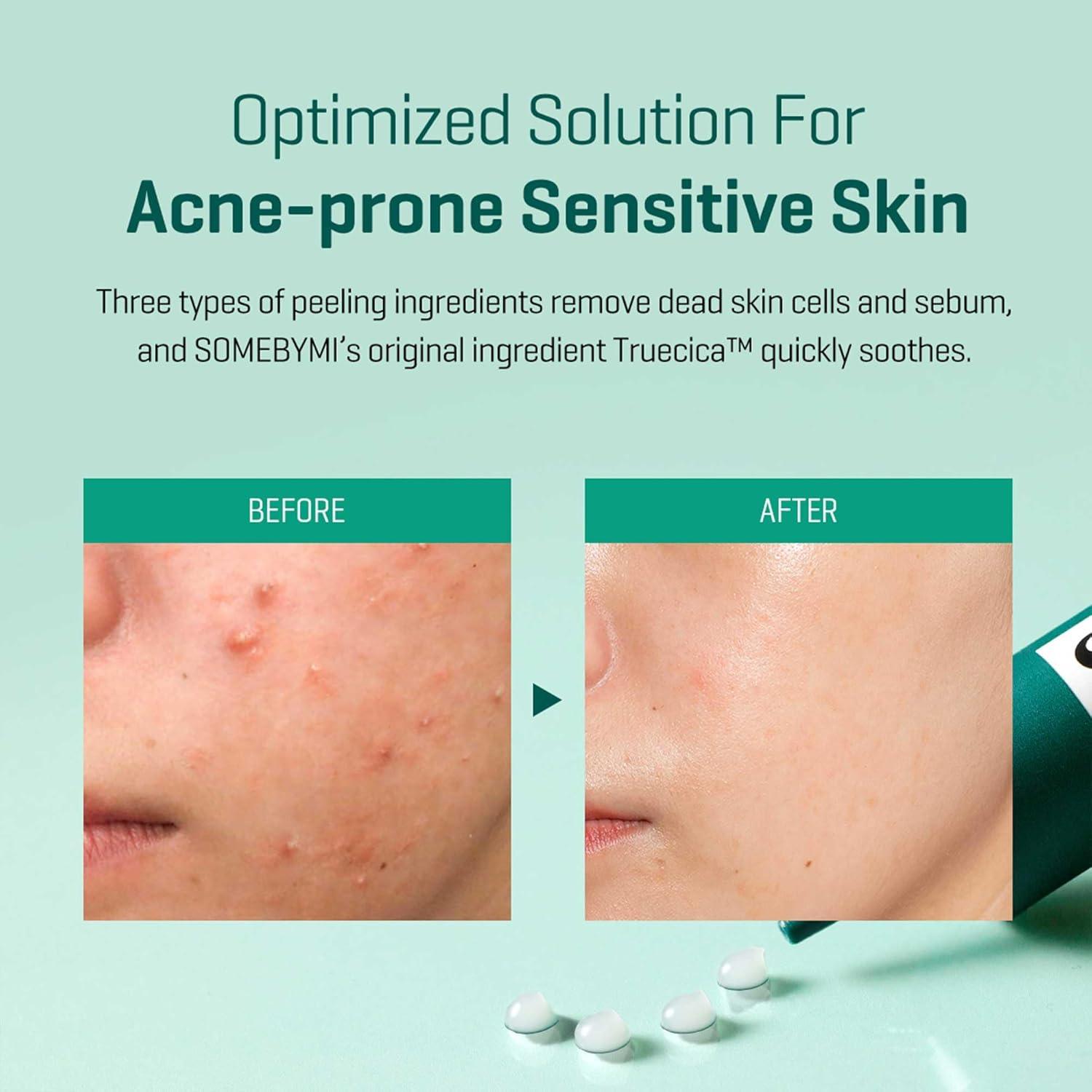 Soonsu Beauty AHA, BHA, PHA 14 Days Super Miracle Spot All Kill Cream application use