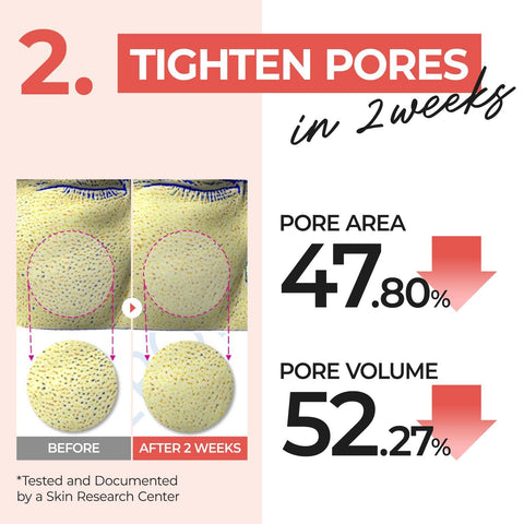 Soonsu Beauty No.4 Pore Zero Peeled Egg Toner Pad 70 Pads 6.42 fl oz packaging design