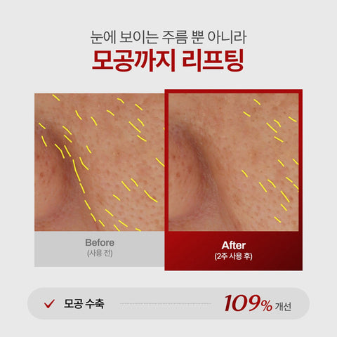 Meditherapy Wrinkle Fit Mask 7P