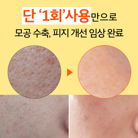 Pibumi Pore Clean Zero LHA Ampoule 50ml (1+1 Set)
