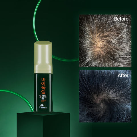 Minoxell Scalp Intensive Hair Loss Ampoule 60ml (3 Pack)