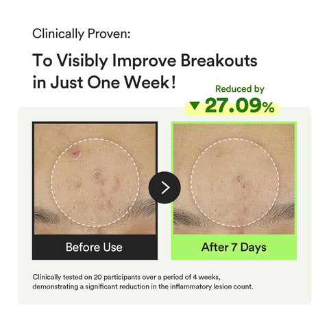 Soonsu Beauty Heartleaf TECA Capsule serum Calming Drop front view